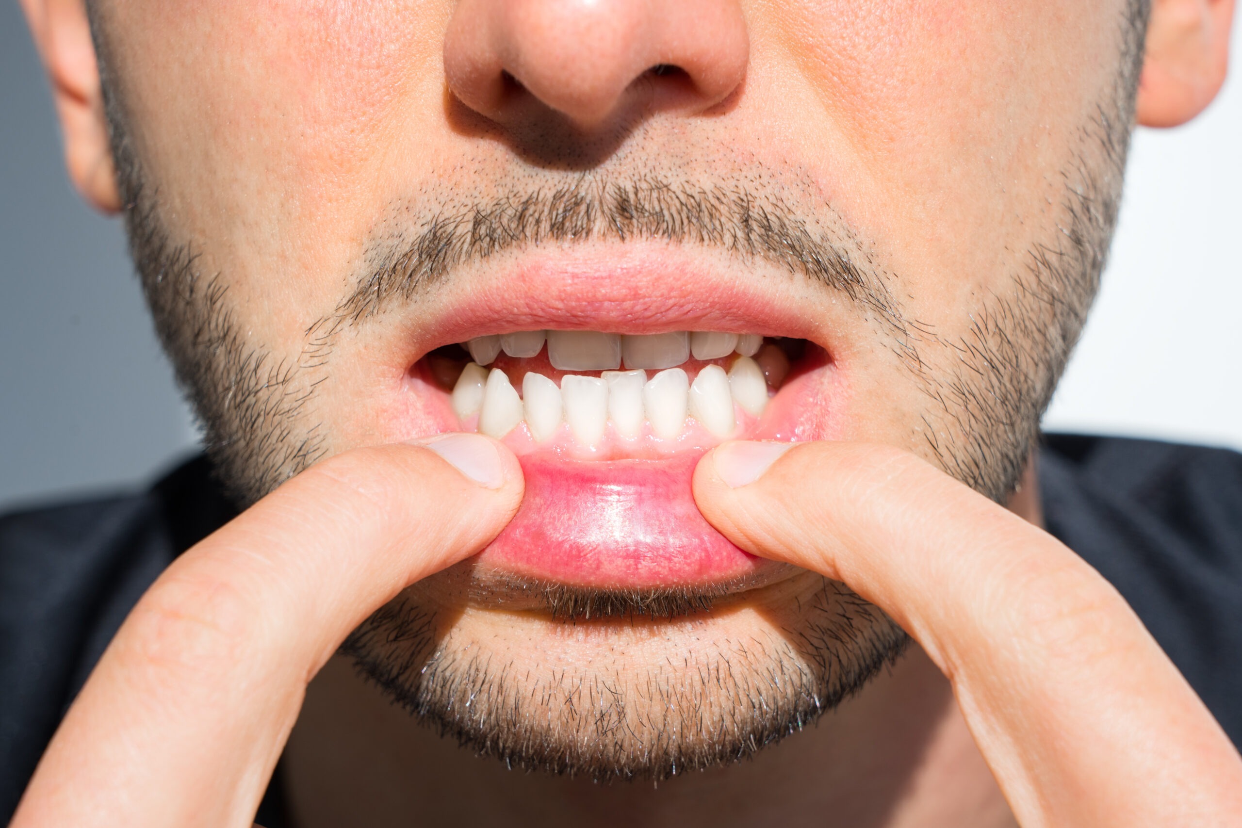 orthodontist in san ramon